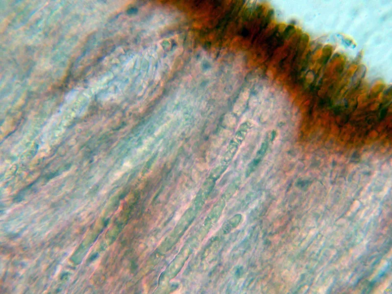 Amylocorticium subincarnatum 10 - Gloeocistidios-001